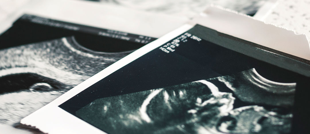 Abortion and the Church, Part 2: Our Calling to End Abortion is Urgent